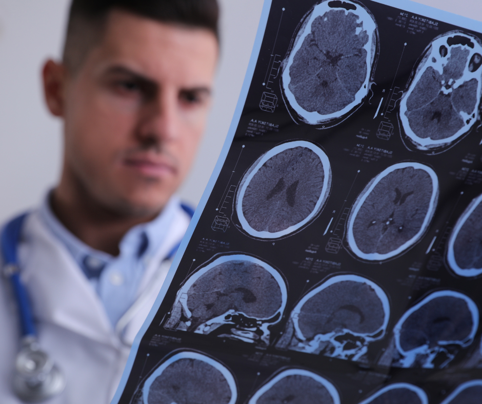 Doctor looking at brain scan images on a screen. Swimmers, Triathletes, Water Polo players and Artistic Swimmers are all at risk of concussion that can have long-term damage to ones mental health. 